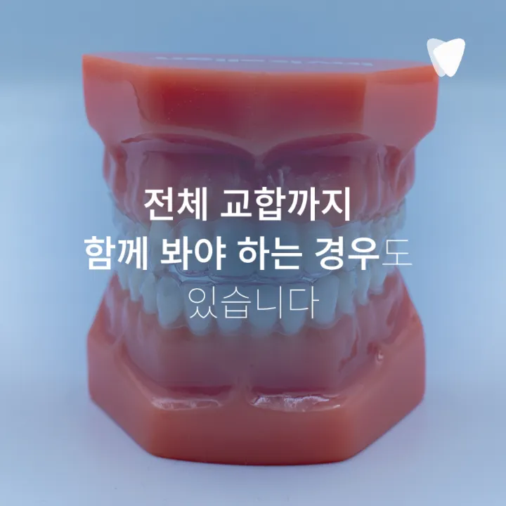 이미지 카드 · 앞니가 조금 틀어졌다면 전체교정이 꼭 필요할까요?