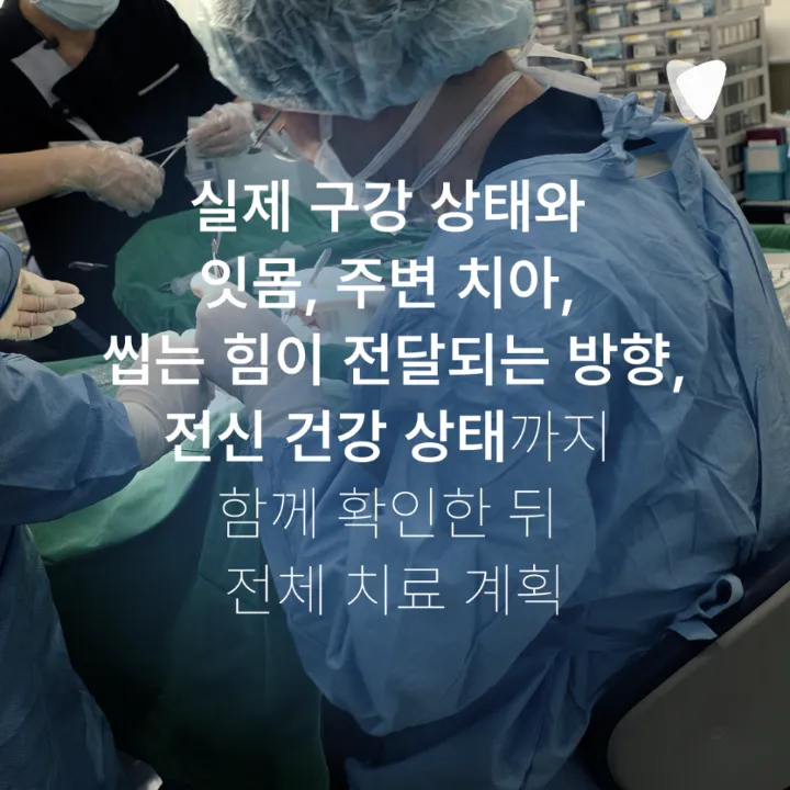 이미지 카드 · 임플란트 뼈이식, 꼭 해야 하는 경우와 아닌 경우