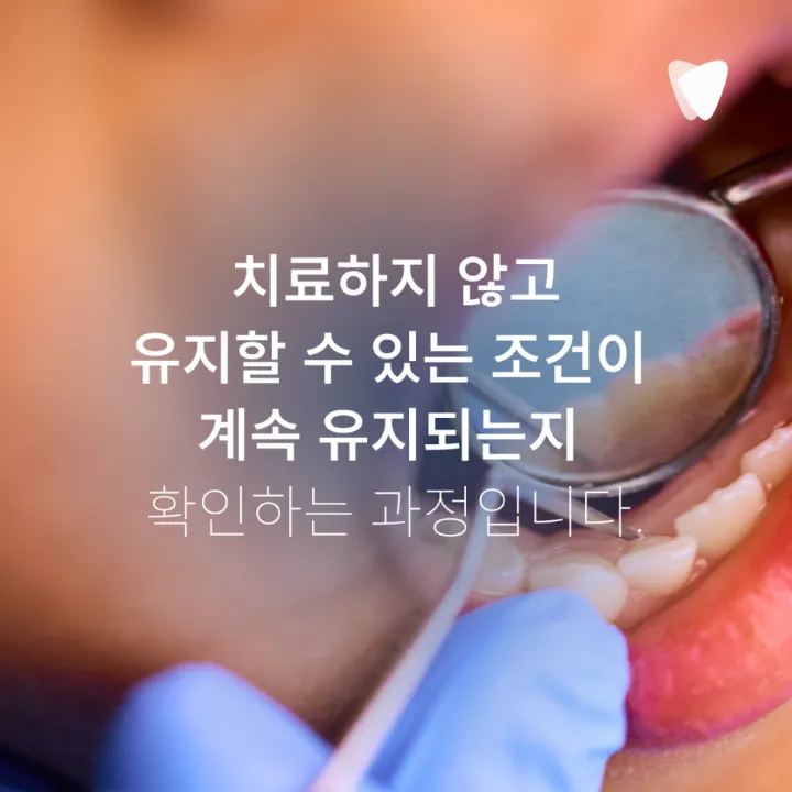 이미지 카드 · 초기 충치, 바로 치료할지 지켜볼지 결정하는 기준