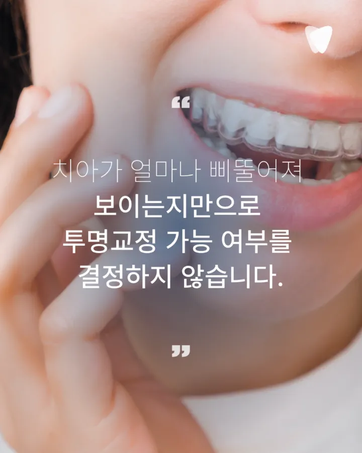 이미지 카드 · 투명교정 가능한 치아와 신중해야 하는 케이스, 무엇으로 나눌까요?