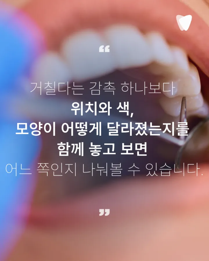 이미지 카드 · 치아 표면이 거칠어진 느낌이 들 때 확인할 것