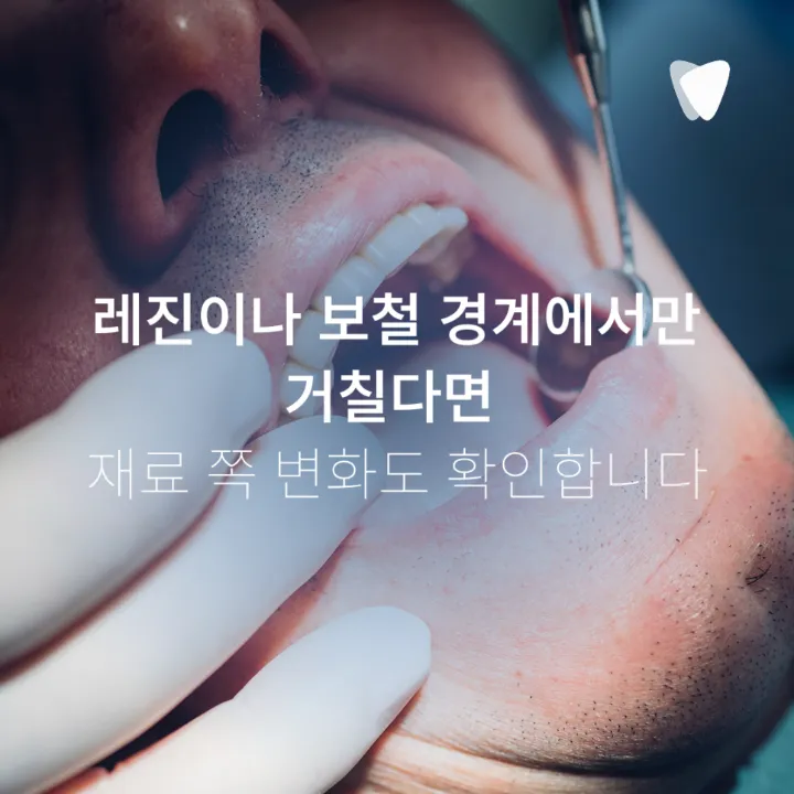 이미지 카드 · 치아 표면이 거칠어진 느낌이 들 때 확인할 것