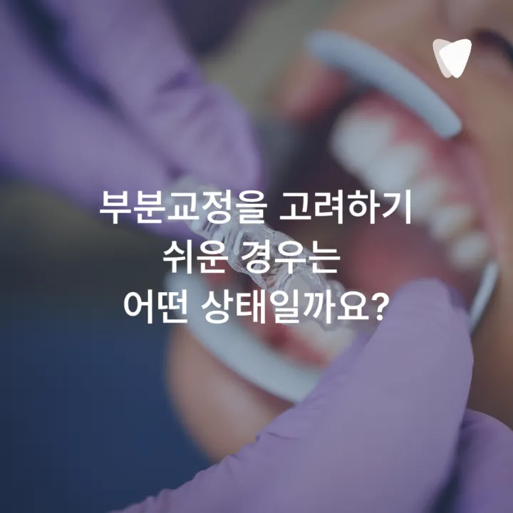 이미지 카드 · 부분교정과 전체교정, 비용보다 먼저 볼 차이