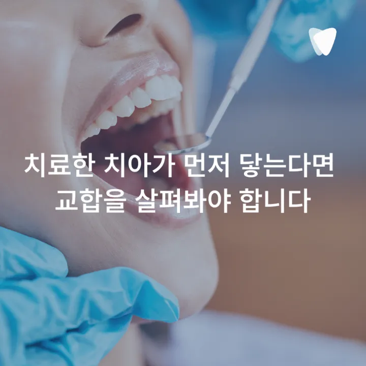 이미지 카드 · 충치 치료 후 씹을 때 아픈 이유, 언제까지 지켜봐도 될까요?