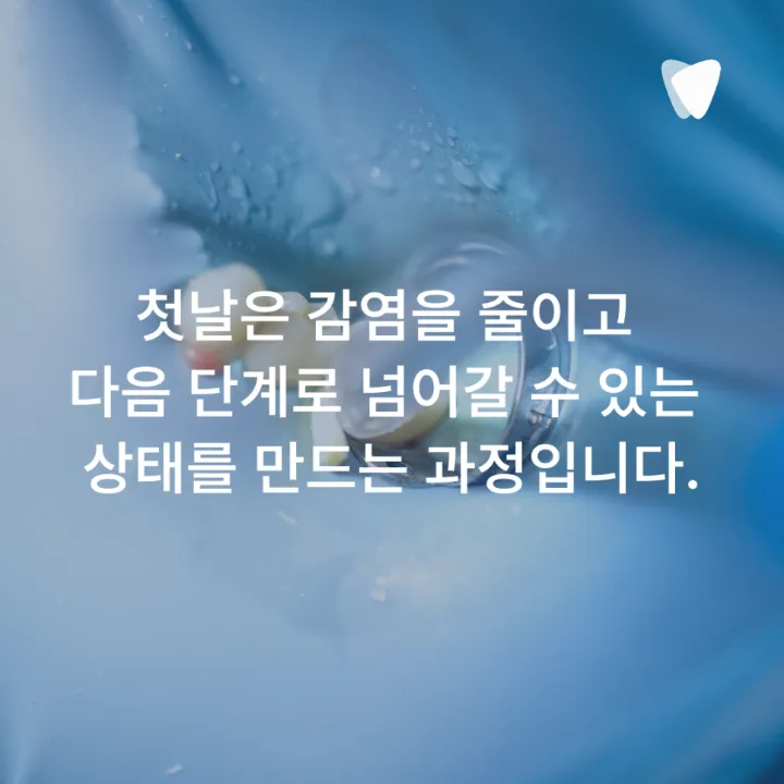 이미지 카드 · 신경치료는 왜 여러 번 받아야 할까요? 한 번에 끝나지 않는 이유