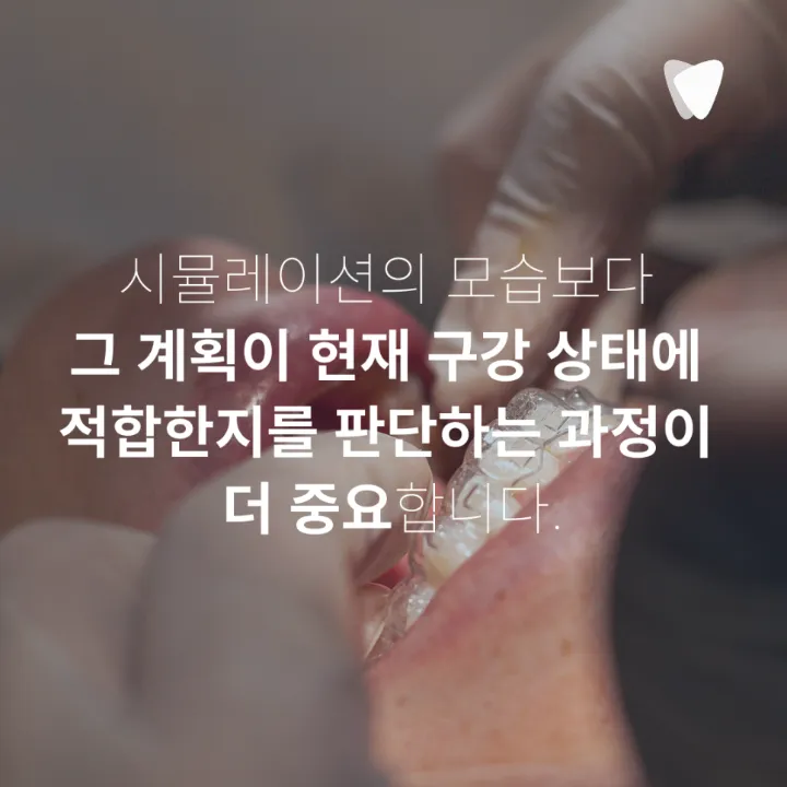 이미지 카드 · 과개교합 투명교정, 앞니가 깊게 물릴 때 무엇을 확인할까요?