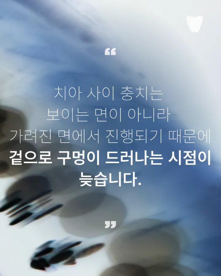 이미지 카드 · 치아 사이 충치는 왜 엑스레이에서 먼저 보일까요?