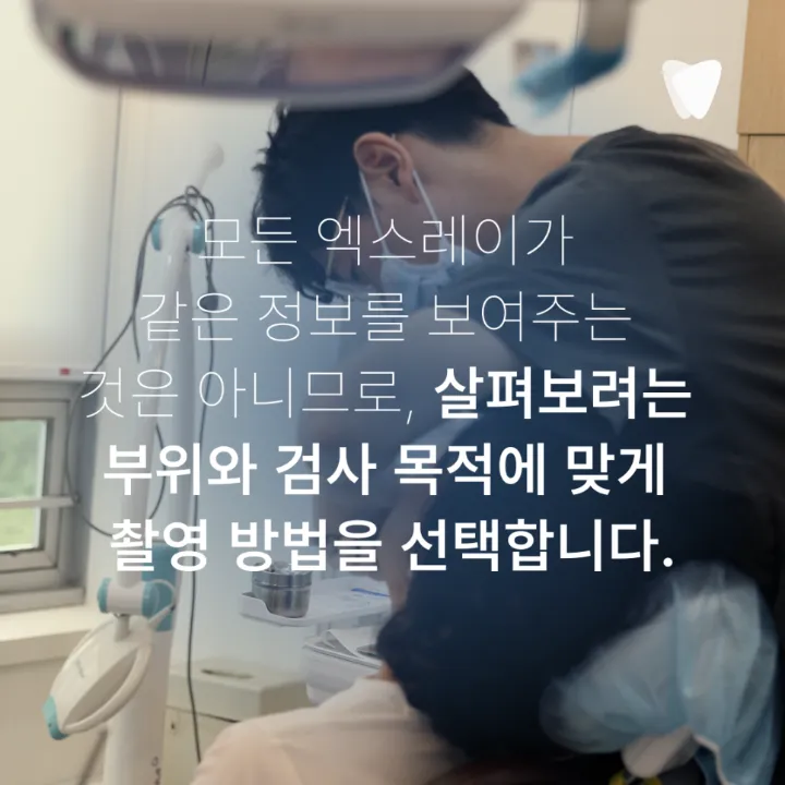 이미지 카드 · 치아 사이 충치는 왜 엑스레이에서 먼저 보일까요?
