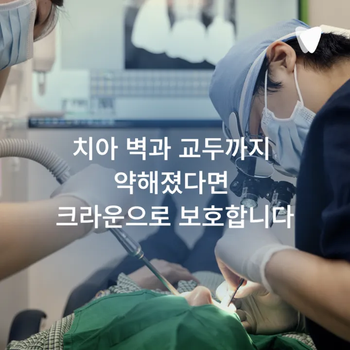 이미지 카드 · 레진·인레이·크라운, 충치 치료 방법이 달라지는 기준