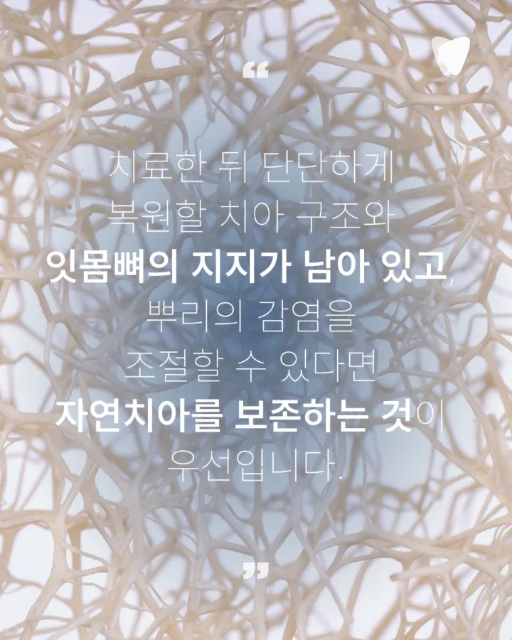 이미지 카드 · 치아를 살릴 수 있을까요? 임플란트와 보존치료를 나누는 기준