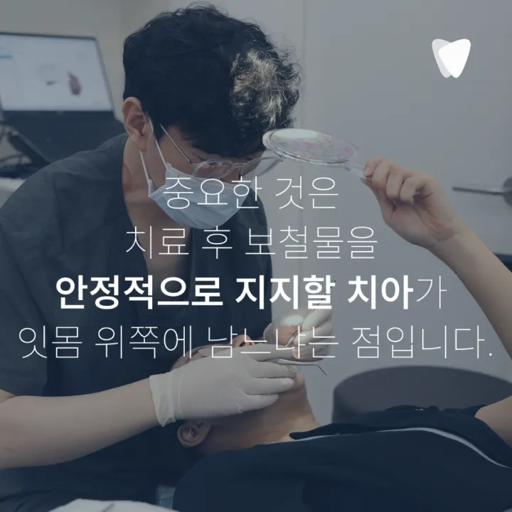 이미지 카드 · 치아를 살릴 수 있을까요? 임플란트와 보존치료를 나누는 기준