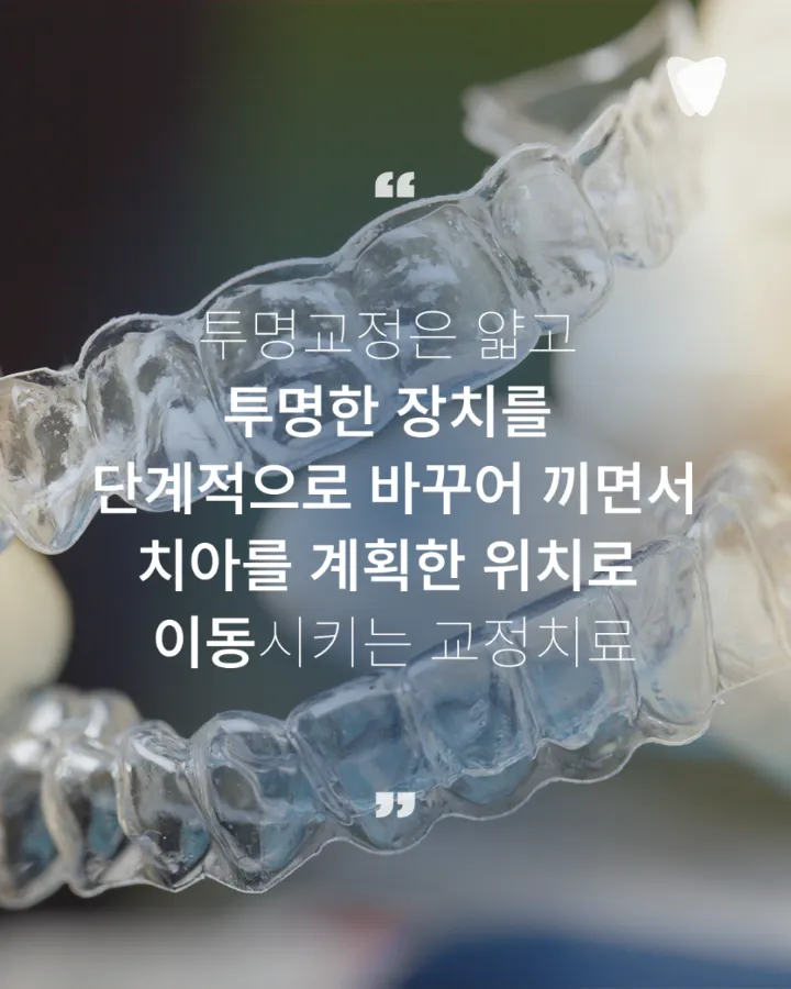 이미지 카드 · 투명교정이란? 장치 원리부터 상담·치료·유지관리까지