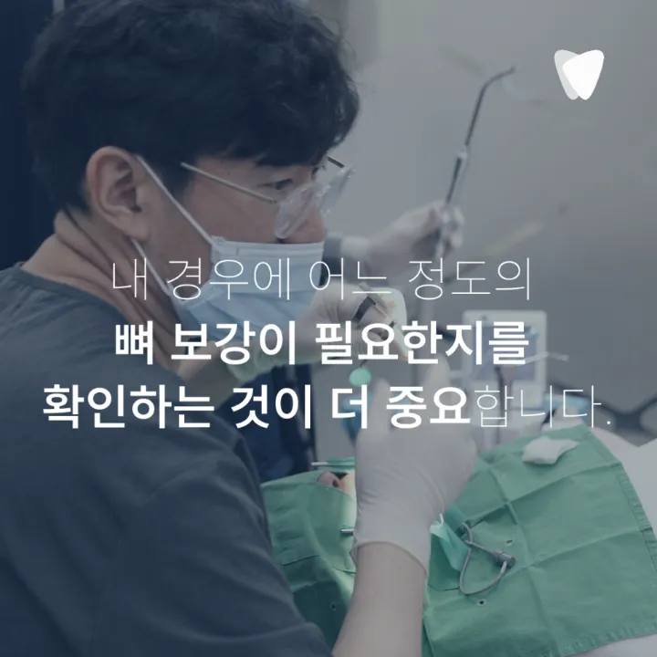 이미지 카드 · 상악동 거상술, 위 어금니 임플란트에서 필요한 경우