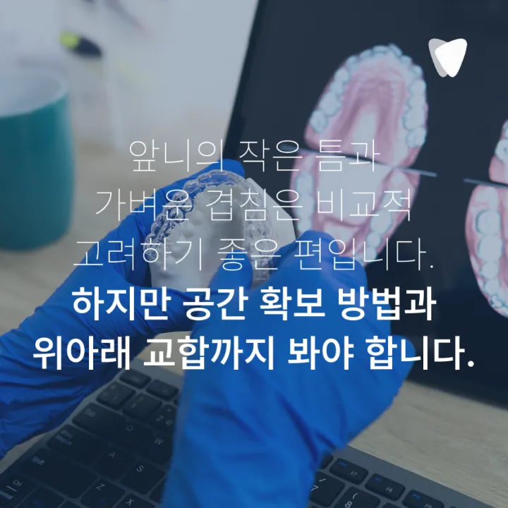이미지 카드 · 투명교정 가능한 치아와 신중해야 하는 케이스, 무엇으로 나눌까요?