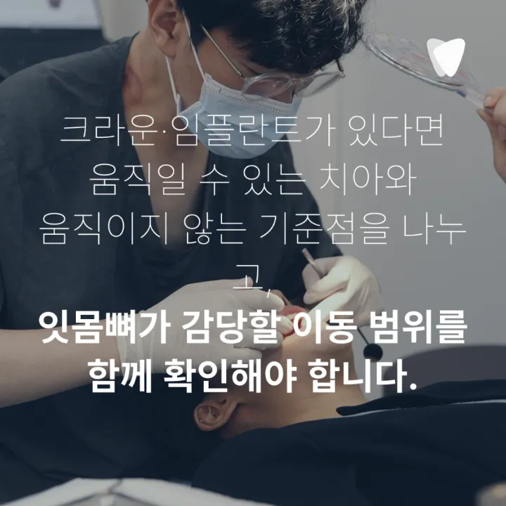 이미지 카드 · 투명교정 가능한 치아와 신중해야 하는 케이스, 무엇으로 나눌까요?