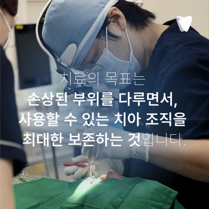 이미지 카드 · 충치는 겉보다 안쪽에서 더 크게 진행될 수 있습니다