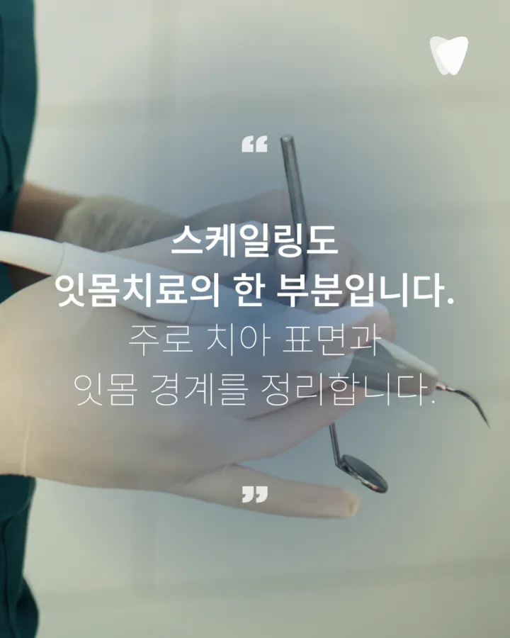 이미지 카드 · 스케일링과 잇몸치료는 어떻게 다를까요