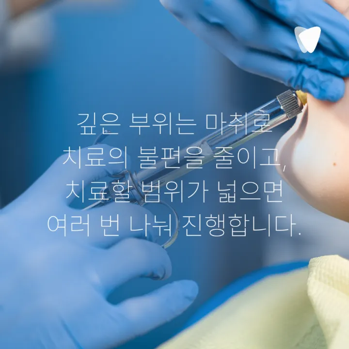 이미지 카드 · 스케일링과 잇몸치료는 어떻게 다를까요