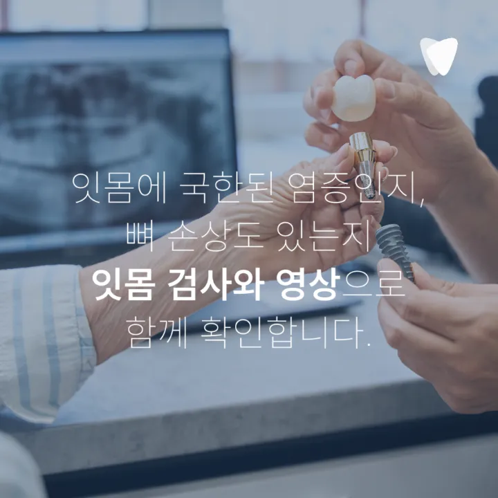 이미지 카드 · 임플란트 주위 잇몸이 붓고 피가 날 때: 점막염·주위염 구분, 연락 시점, 검사와 관리