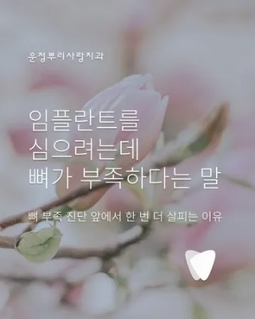 임플란트 전 뼈가 부족하다는 진단, 정말 뼈이식이 꼭 필요할까?