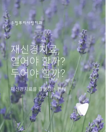 열어야 할까, 두어야 할까 — 재신경치료를 결정하는 판단 앞에서