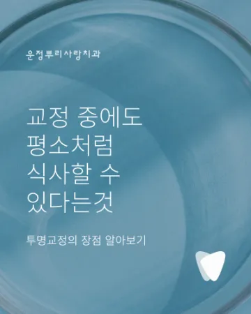 교정 중에도 평소처럼 식사할 수 있다는 특별함