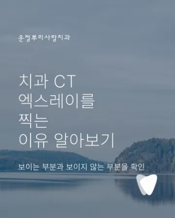 치과 CT 꼭 찍어야 하나요? 사진·엑스레이를 찍는 이유