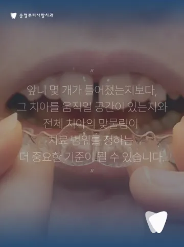 앞니가 조금 틀어졌다면 전체교정이 꼭 필요할까요?