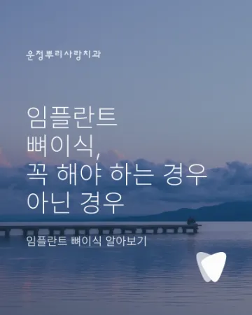 임플란트 뼈이식, 꼭 해야 하는 경우와 아닌 경우