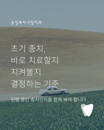 초기 충치, 바로 치료할지 지켜볼지 결정하는 기준
