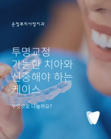 투명교정 가능한 치아와 신중해야 하는 케이스, 무엇으로 나눌까요?