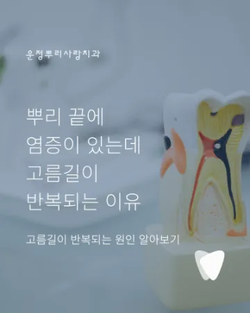 뿌리 끝에 염증이 있는데 고름길이 반복되는 이유