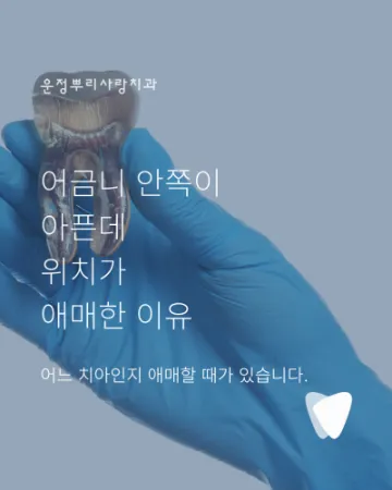 어금니 안쪽이 묵직하게 아픈데 위치가 애매한 이유