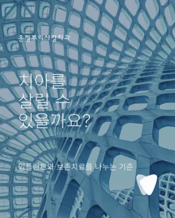 치아를 살릴 수 있을까요? 임플란트와 보존치료를 나누는 기준