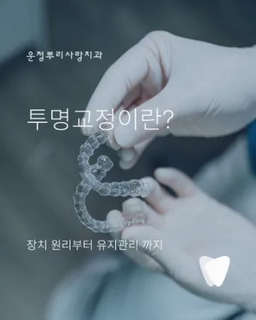 투명교정이란? 장치 원리부터 상담·치료·유지관리까지