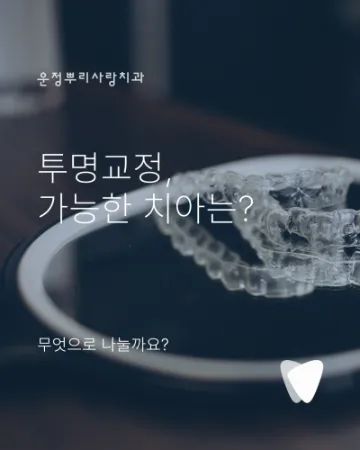 투명교정 가능한 치아와 신중해야 하는 케이스, 무엇으로 나눌까요?