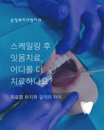 스케일링과 잇몸치료는 어떻게 다를까요