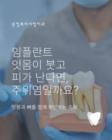 임플란트 주위 잇몸이 붓고 피가 날 때: 점막염·주위염 구분, 연락 시점, 검사와 관리